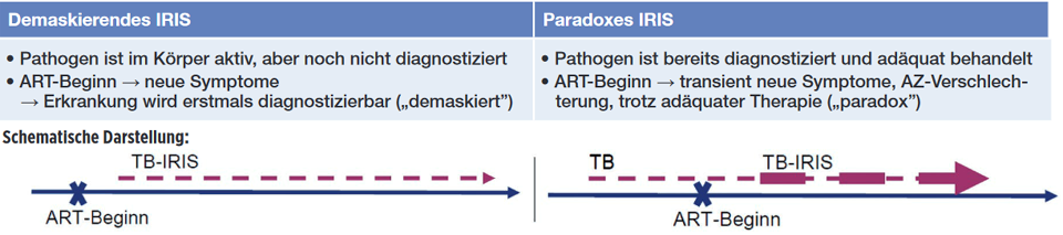 ART, antiretroviral therapy; IRIS, immune reconstitution inflammation syndrome; TB, tuberculosis